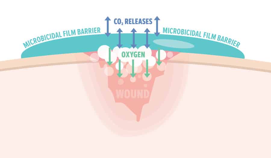 DuraDerm SPORT creates a waterproof barrier to promote healing